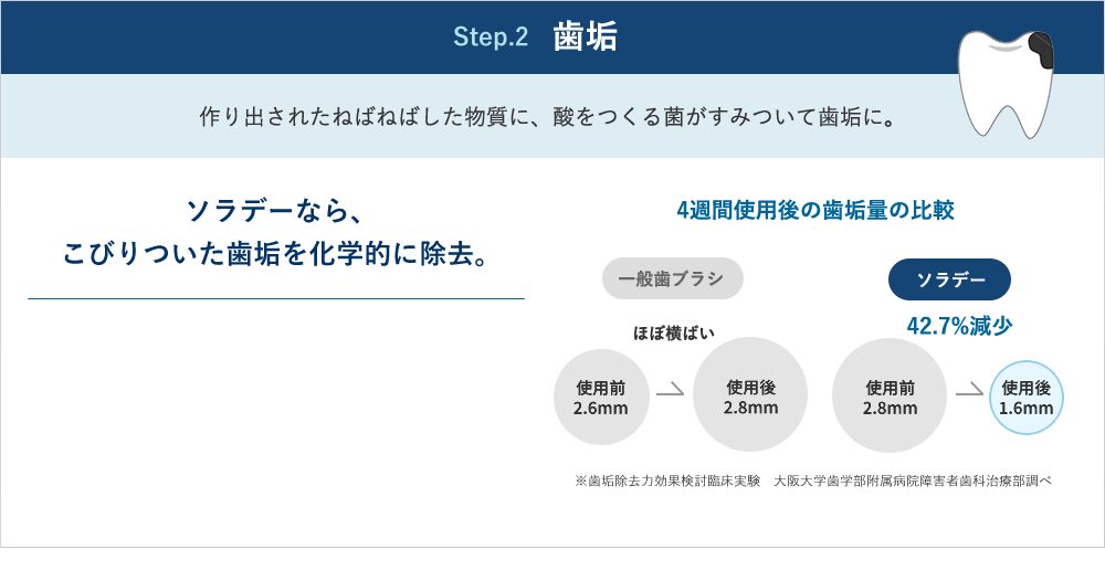 Step.2 歯垢 作り出されたねばねばした物質に、酸をつくる菌がすみついて歯垢に。ソラデーなら、こびりついた歯垢を化学的に除去。